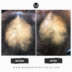 Mane Affair Studio - Before and after 30 days of hair loss solutions program