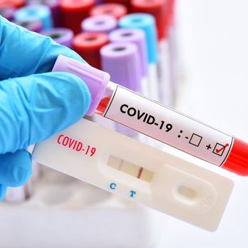 COVID Testing Center - Urgent Care Near Me - Los Angeles, California COVID Testing Center - Urgent Care Near Me - Los Angeles, California