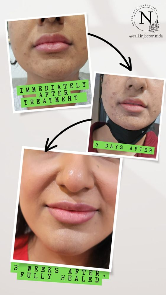 Noble Art Aesthetics Logo