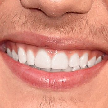 Dazzling Smile Dental Group - General Dentistry Near Me - Costa Mesa, California