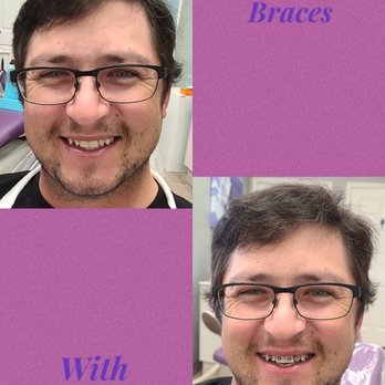 Personalized Orthodontics - Orthodontists Near Me - Sparks, Nevada