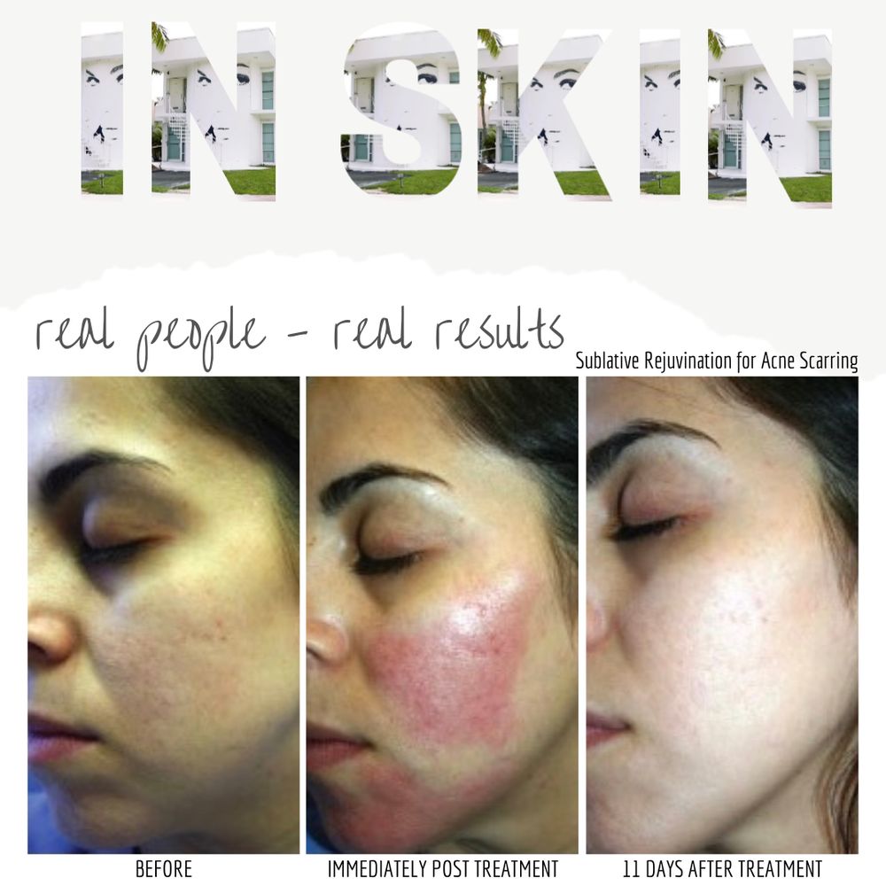 IN SKIN Updated March 2024 Request an Appointment 13 Photos