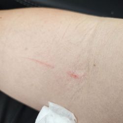 Quest Diagnostics - When she pulled out, she too scrape my skin with the needle.