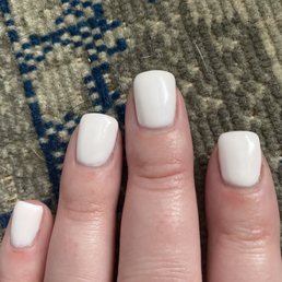 Inflamed cuticle from electric sander cutting them.