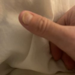 7 months later still suffering with the same nail fungus