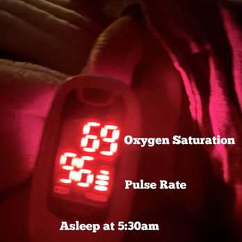 Torrance Memorial Medical Center - My wife's Oxygen was fluctuating between 69 & 95 yet 2hours wait? - Hospitals Near Me - Torrance, California Torrance Memorial Medical Center - My wife's Oxygen was fluctuating between 69 & 95 yet 2hours wait? - Hospitals Near Me - Torrance, California