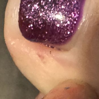 V Nail Spa - As you can see a little cut to the left of my big toe on my left foot. She did the with the spinning sand when she was taking the gel off. - Nail Salons Near Me - Los Angeles, California V Nail Spa - As you can see a little cut to the left of my big toe on my left foot. She did the with the spinning sand when she was taking the gel off. - Nail Salons Near Me - Los Angeles, California