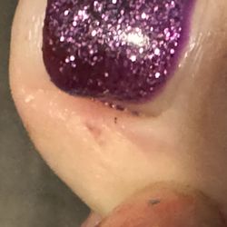 V Nail Spa - As you can see a little cut to the left of my big toe on my left foot. She did the with the spinning sand when she was taking the gel off.