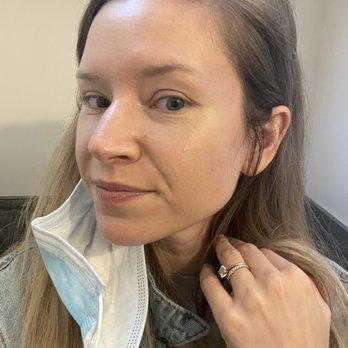 SoLuna Aesthetics - Before - Eyelash Service Near Me - Scottsdale, Arizona SoLuna Aesthetics - Before - Eyelash Service Near Me - Scottsdale, Arizona