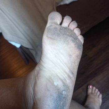 Super 8 by Wyndham Denver Stapleton - I came into your room and took my shoes off. Ever left the room, and my feet looked like this. The floors were gross. - Hotels Near Me - Denver, Colorado