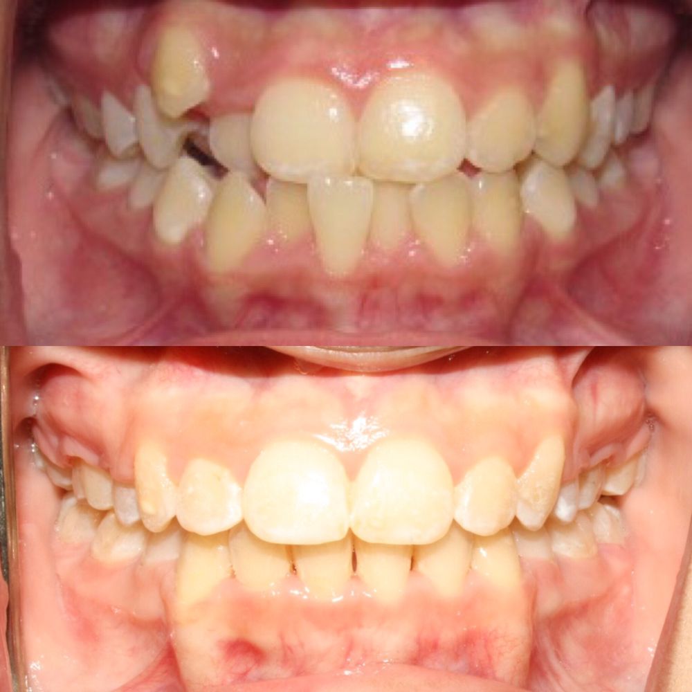 UPLAND DENTAL IMPLANT & ORTHODONTICS 15 Photos & 15 Reviews