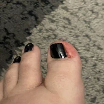 iNails And Spa - Keeps bleeding after pedicure. - Skin Care Near Me - Chula Vista, California iNails And Spa - Keeps bleeding after pedicure. - Skin Care Near Me - Chula Vista, California