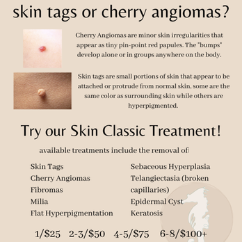 Charlotte Sugaring - Skin classic Treatment info - Skin Care Near Me - Matthews, North Carolina