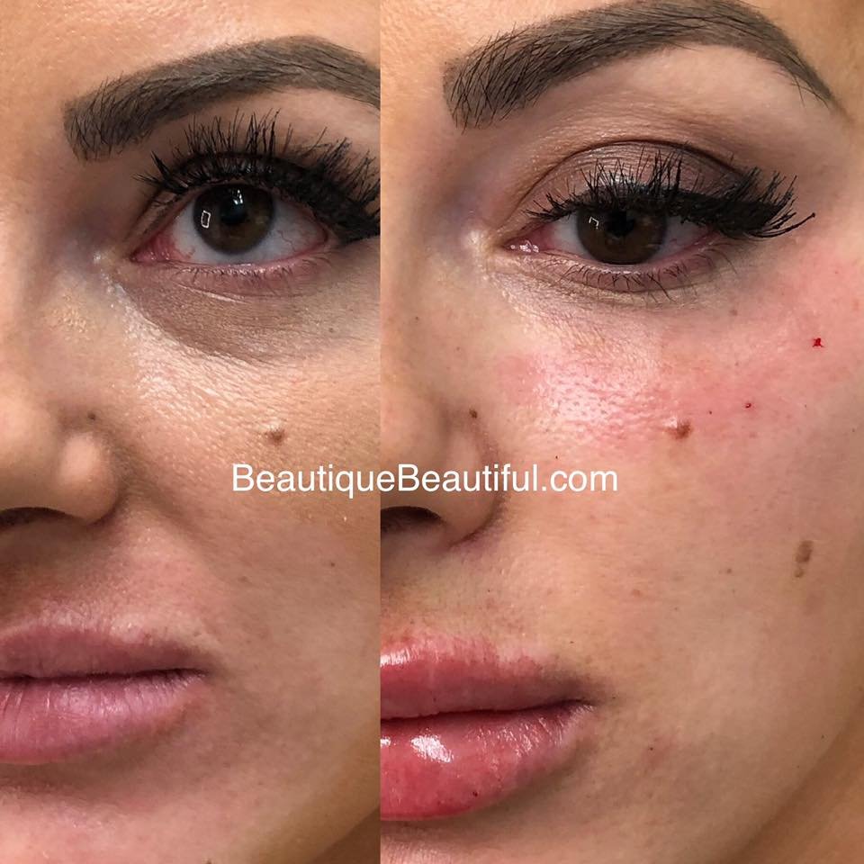 BEAUTIQUE MEDICAL ANTIAGING 314 Photos & 25 Reviews 10542 Kingston Pike, Knoxville