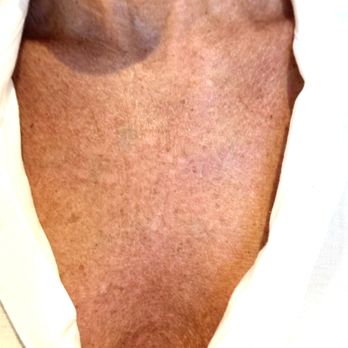 BeautyCamo - Even pre tan I no longer see the dark ring! This is only 1 week after! - Permanent Makeup Near Me - Newport Beach, California