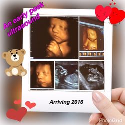 An Early Peek Ultrasound
