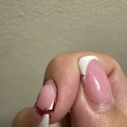 Broken nails