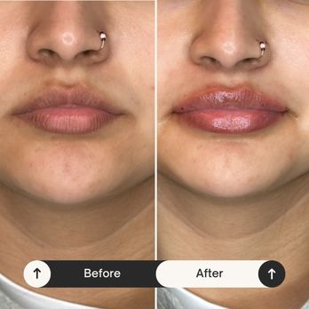 Dermal Knowledge - Medical Spas Near Me - Grayson, Georgia