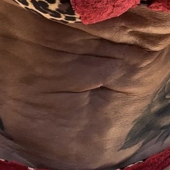 Cosmetic Surgery Affiliates - Abdomen post surgery - Cosmetic Surgeons Near Me - Oklahoma City, Oklahoma Cosmetic Surgery Affiliates - Abdomen post surgery - Cosmetic Surgeons Near Me - Oklahoma City, Oklahoma