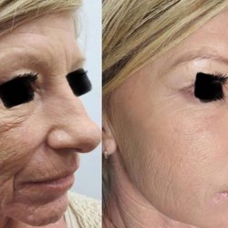 Lilly Beauty Medical Spa Escondido