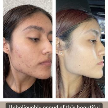 Ethereal Day Spa - Skin Care Near Me - Temecula, California Ethereal Day Spa - Skin Care Near Me - Temecula, California