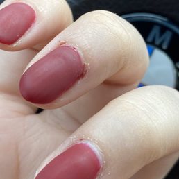 deep cuts in my cuticle