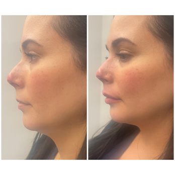 Universal Laser Center - Laser Hair Removal Near Me - Miami, Florida