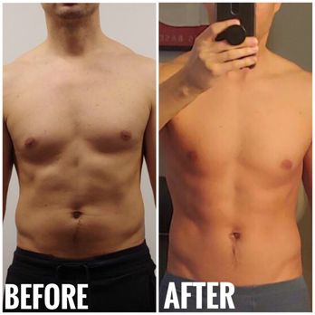 Bodcor West Valley - Bodcor targets fat cells and tightens skin. - Weight Loss Centers Near Me - Avondale, Arizona Bodcor West Valley - Bodcor targets fat cells and tightens skin. - Weight Loss Centers Near Me - Avondale, Arizona