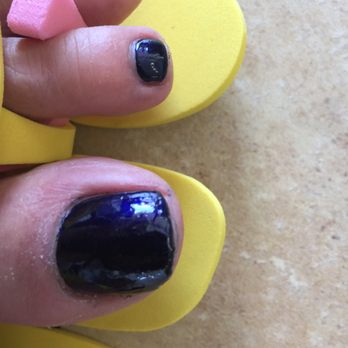 City Nails and Spa - Toe nail is crooked - Nail Salons Near Me - Greensburg, Pennsylvania City Nails and Spa - Toe nail is crooked - Nail Salons Near Me - Greensburg, Pennsylvania