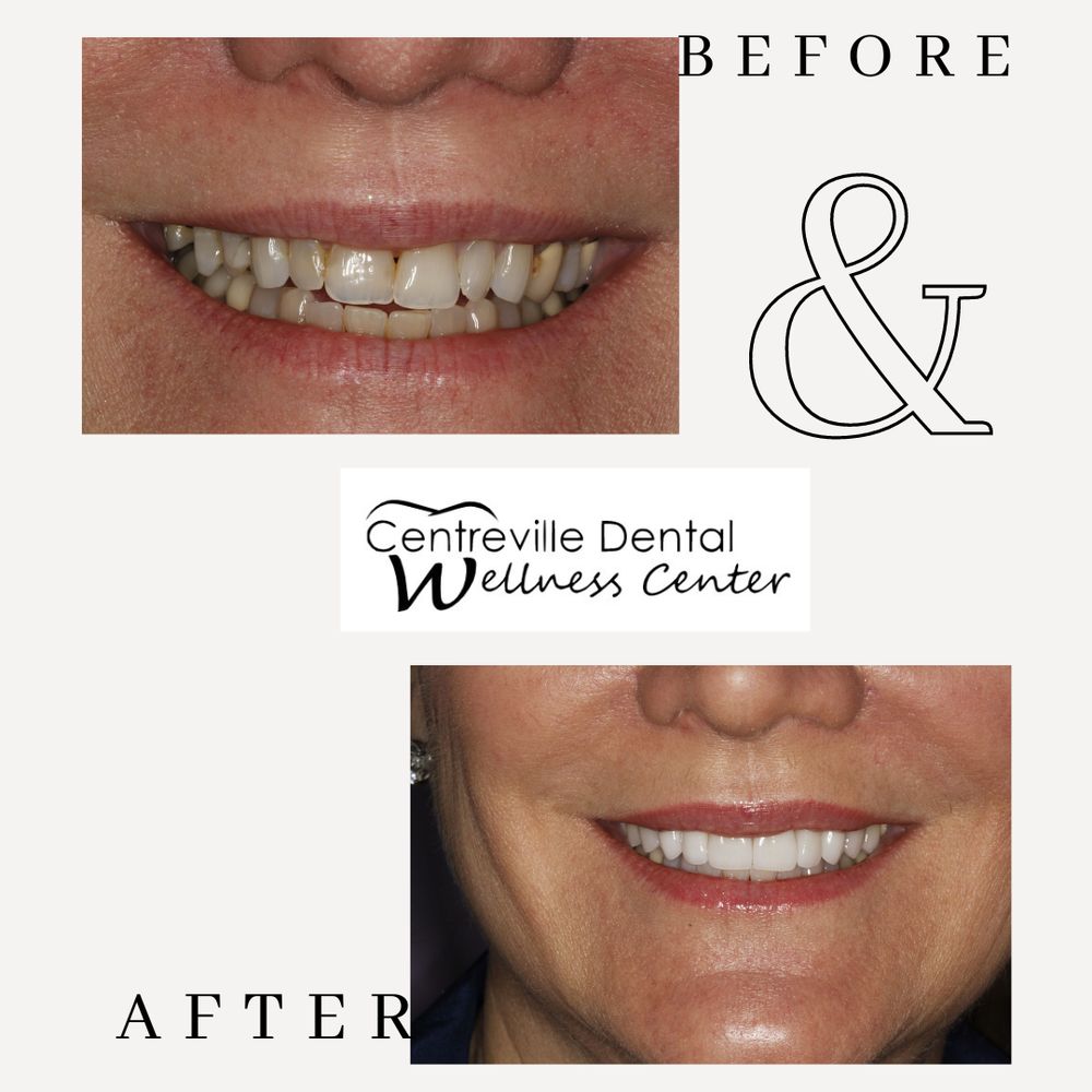 Centreville Dental Wellness Center