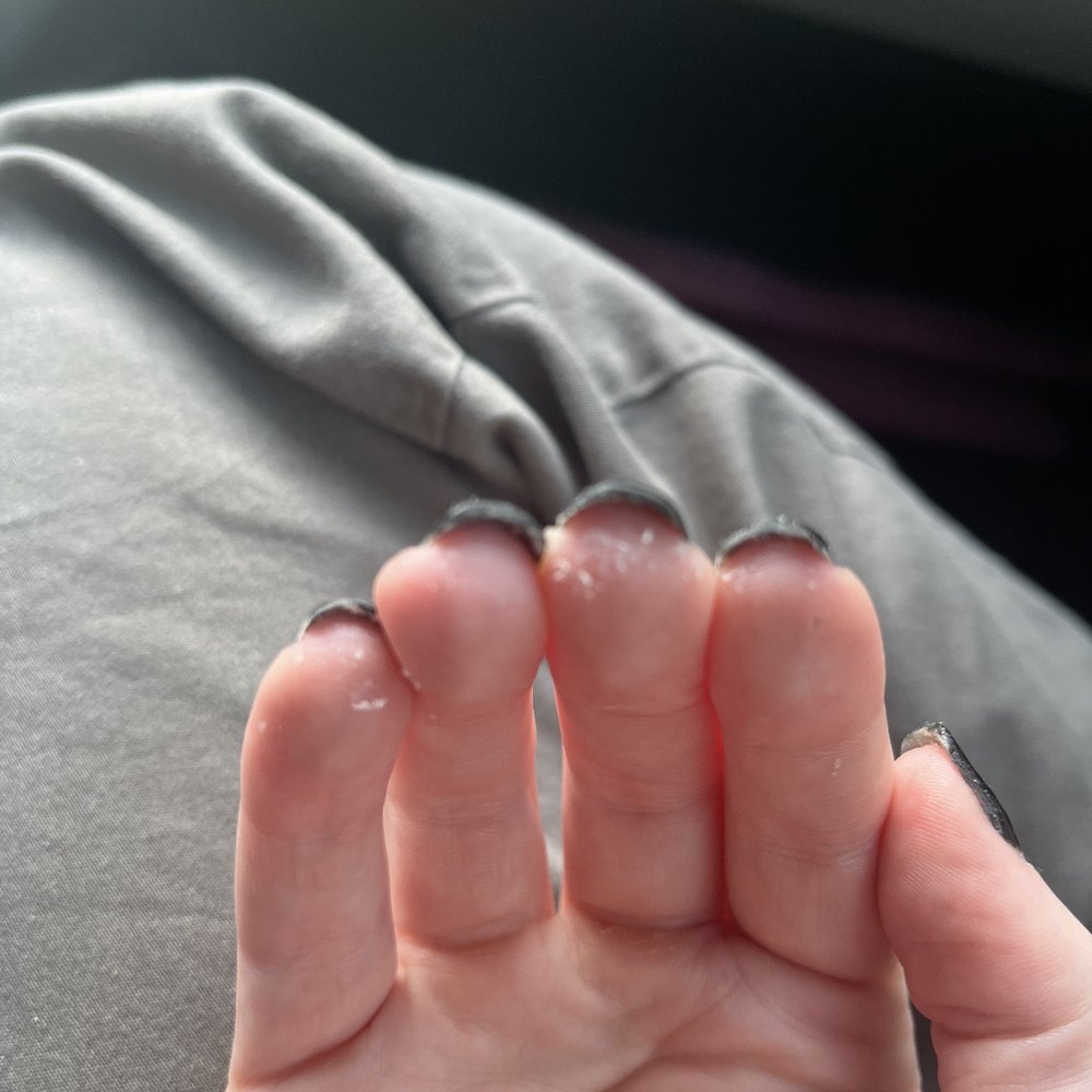 Fingertips covered in acrylic goop Fingertips covered in acrylic goop