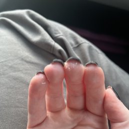 Fingertips covered in acrylic goop Fingertips covered in acrylic goop