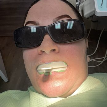 Lone Mountain Dental Las Vegas - Being prepped for a bridge - General Dentistry Near Me - Las Vegas, Nevada