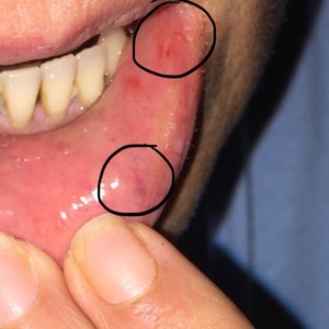 SEXTON DENTAL CLINIC - Updated June 2024 - 47 Reviews - 377 W Palmetto