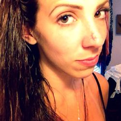 Dr. Barış Çakır - Infection after the surgery. He ruined my life