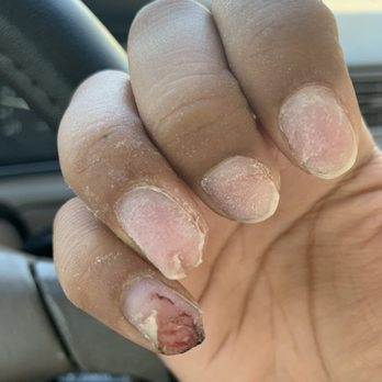Tnails spa - Missing my nail on my pinky finger. - Nail Salons Near Me - San Jose, California