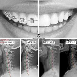 Serenity Holistic Healthcare - Alignment is important and takes time. Spinal hygiene is important and necessary.
