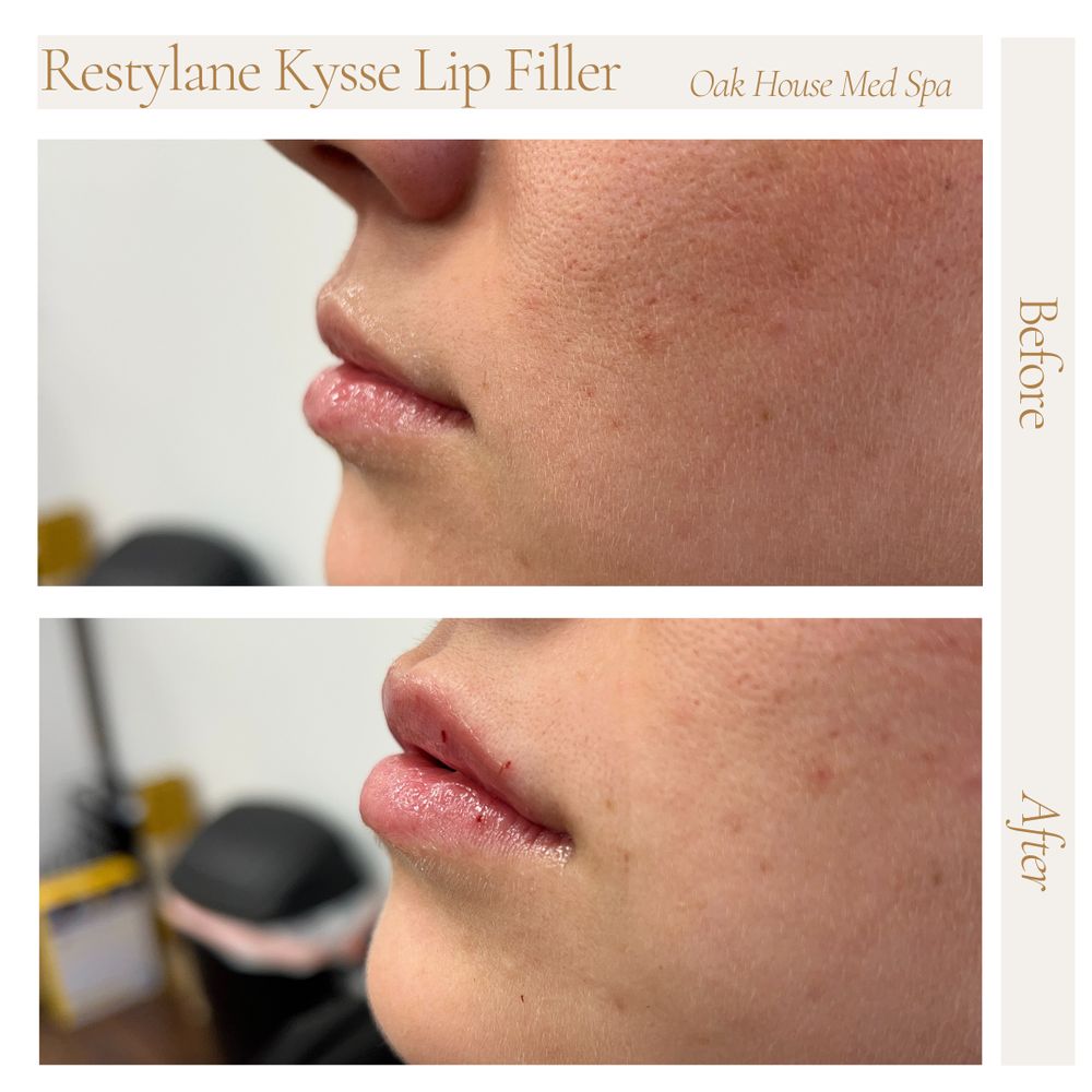 semaglutide side effect class action in dallas dallas semaglutide stomach paralysis law office Ozempic Lawsuit for  Blindness, Stomach Paralysis and Injury Claims