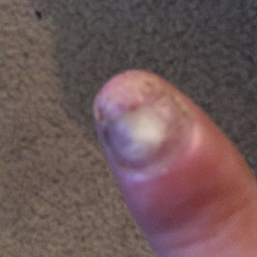 Medina Nails - Another pic of the aftermath of medina nails!!! - Nail Salons Near Me - Bellevue, Washington Medina Nails - Another pic of the aftermath of medina nails!!! - Nail Salons Near Me - Bellevue, Washington