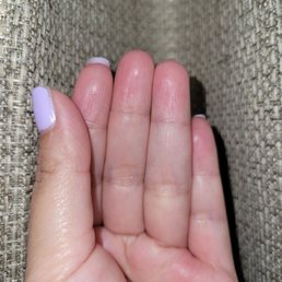 You can see the chipped nail polish and uneven nails length You can see the chipped nail polish and uneven nails length