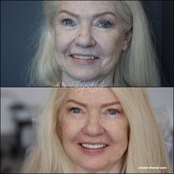 Mojdeh Shayestehfar, DDS - Linden Dental Care - A rejuvenated smile can truly freshen the face!