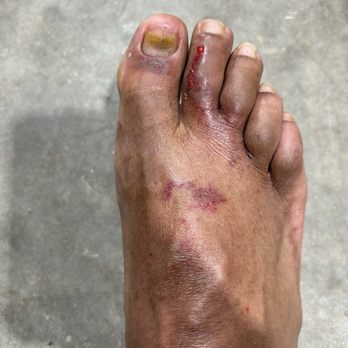 Amor Nails & Spa - I liked this place and I took my husband there for a pedi and we told them he was pre diabetic so when this happened - Waxing Near Me - Austin, Texas