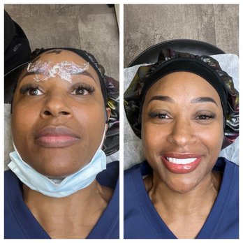 Hailey's IBeauty - Touch up on brows and lip blush (1st session) - Permanent Makeup Near Me - San Jose, California Hailey's IBeauty - Touch up on brows and lip blush (1st session) - Permanent Makeup Near Me - San Jose, California