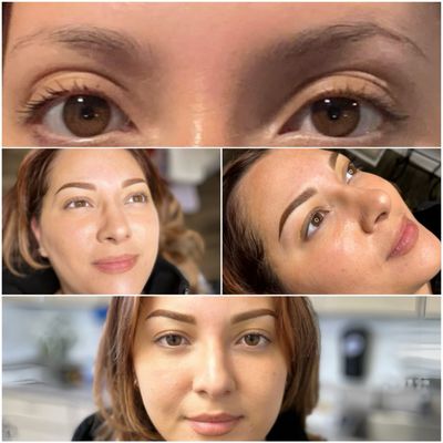 Eyebrows (Microblading, Nano Brows, Powder Brows Ombre, Colour Correction, Follow Ups) - Here at PMU, we offer:
Microblading - Microblading is a tattooing technique and form of permanent makeup in which a small handheld tool made of several tiny needles is used to add semi-permanent pigment to the skin. Microblading differs from standard permanent brows, as each hairstroke is created by hand using a blade which creates fine slices in the skin.
Nano Brows - Nano-blading is a form of brow tattooing that implements a handheld tattoo machine tool and one very fine needle (as opposed to microblading, which uses several) to semi-permanently lay pigment under the skin, approximating the look of actual eyebrow hairs.
Powder Brows Ombre - Ombre brows, also known as Powdered Brows, are a semi-permanent eyebrow styling technique that creates a soft shaded brow pencil look. This amazing technique, first developed in Asia, has been around for decades and has been gradually improving over the years. It gives great definition & depth to the eyebrows. It is particularly recommended for women with oily skin or combination skin or anyone who fills in their brows regularly with pencil or shadow.
Color Correction - If you do notice that your brows have turned red or blue, you may be able to correct the colour with a pigment corrector. This is recommended for clients with a good shape and the old tattoo has already faded over 50%. Pigment corrector can help neutralize the blue/red tone in your skin and restore your brows to a brown base. In cases where the existing pigment in the skin is still heavily saturated, laser or saline removal session is recommended before getting a new procedure done.
Follow Ups - FOLLOW UP SESSIONS:
$250 Up to 3 months (from date of initial procedure applicable towards returning clients only)
ANY ADDITIONAL FOLLOW UP SESSIONS THEREAFTER STARTS AT $250 & UP.
Returning Clients 1+ years
Returning clients receive a loyalty discount of $150 off of current full rate. Eyebrows (Microblading, Nano Brows, Powder Brows Ombre, Colour Correction, Follow Ups) - Here at PMU, we offer:
Microblading - Microblading is a tattooing technique and form of permanent makeup in which a small handheld tool made of several tiny needles is used to add semi-permanent pigment to the skin. Microblading differs from standard permanent brows, as each hairstroke is created by hand using a blade which creates fine slices in the skin.
Nano Brows - Nano-blading is a form of brow tattooing that implements a handheld tattoo machine tool and one very fine needle (as opposed to microblading, which uses several) to semi-permanently lay pigment under the skin, approximating the look of actual eyebrow hairs.
Powder Brows Ombre - Ombre brows, also known as Powdered Brows, are a semi-permanent eyebrow styling technique that creates a soft shaded brow pencil look. This amazing technique, first developed in Asia, has been around for decades and has been gradually improving over the years. It gives great definition & depth to the eyebrows. It is particularly recommended for women with oily skin or combination skin or anyone who fills in their brows regularly with pencil or shadow.
Color Correction - If you do notice that your brows have turned red or blue, you may be able to correct the colour with a pigment corrector. This is recommended for clients with a good shape and the old tattoo has already faded over 50%. Pigment corrector can help neutralize the blue/red tone in your skin and restore your brows to a brown base. In cases where the existing pigment in the skin is still heavily saturated, laser or saline removal session is recommended before getting a new procedure done.
Follow Ups - FOLLOW UP SESSIONS:
$250 Up to 3 months (from date of initial procedure applicable towards returning clients only)
ANY ADDITIONAL FOLLOW UP SESSIONS THEREAFTER STARTS AT $250 & UP.
Returning Clients 1+ years
Returning clients receive a loyalty discount of $150 off of current full rate.