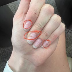 Diamond Nail - Green nails from the fungal growth after the nail tech didn't properly seal my nails.