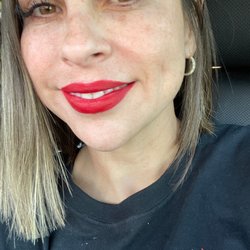 MD Beauty Spa - 24hrs after Morpheus8