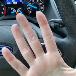 Acrylic stuck to my hands because I was told to soak my hands in big bowl of acetone to remove previous nails Acrylic stuck to my hands because I was told to soak my hands in big bowl of acetone to remove previous nails