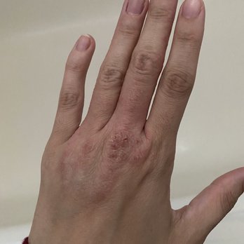 Worthy Self-Care Studio - After one red light therapy and ballancer pro session - Saunas Near Me - Berkeley, California