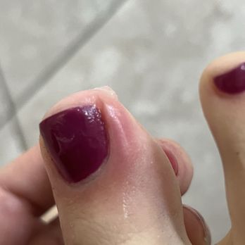 Orchid Nails & Spa - Ingrown from cutting down side. - Nail Salons Near Me - Roseville, California
