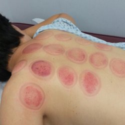 Youngwoo Acupuncture & Herbs Clinic